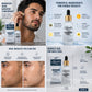 Yardco Whitening Serum – Anti Acne & Dark Spot Corrector For Men 30ml